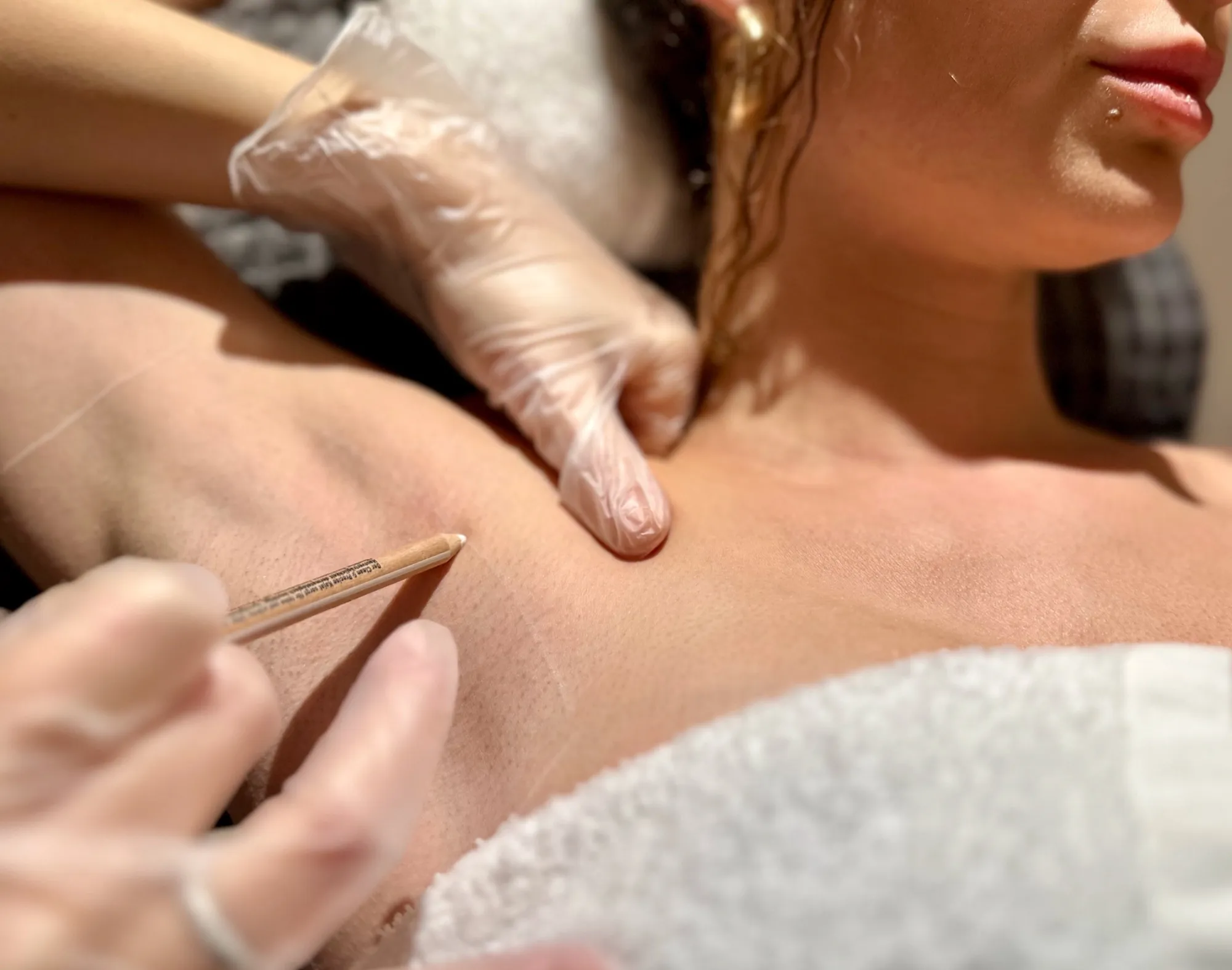 Permanent Laser Hair Removal Düsseldorf
